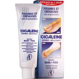 AKILEÏNE Soin de Corps Pieds Baume Mains et Pieds Fissures et Crevasses 30ml